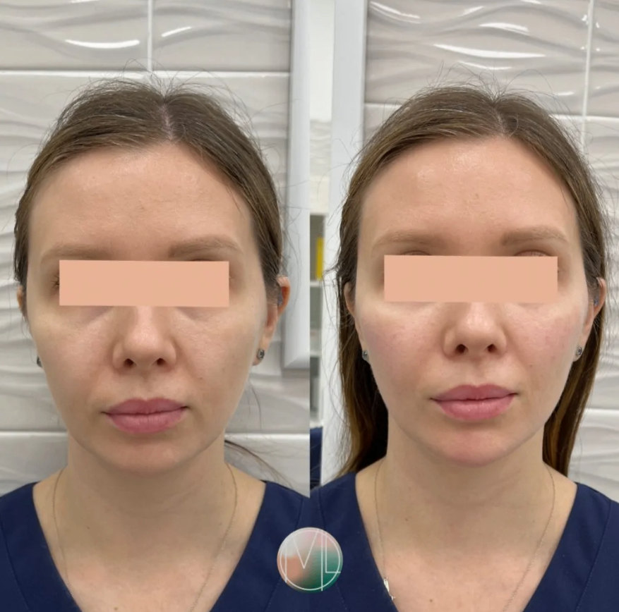 529042668__https://filllin.ru/api/media/doctor/8ae4f45b-f0fa-414d-91ea-63d4f5789e4f-68d2b334d611ae3c0dcef079.png