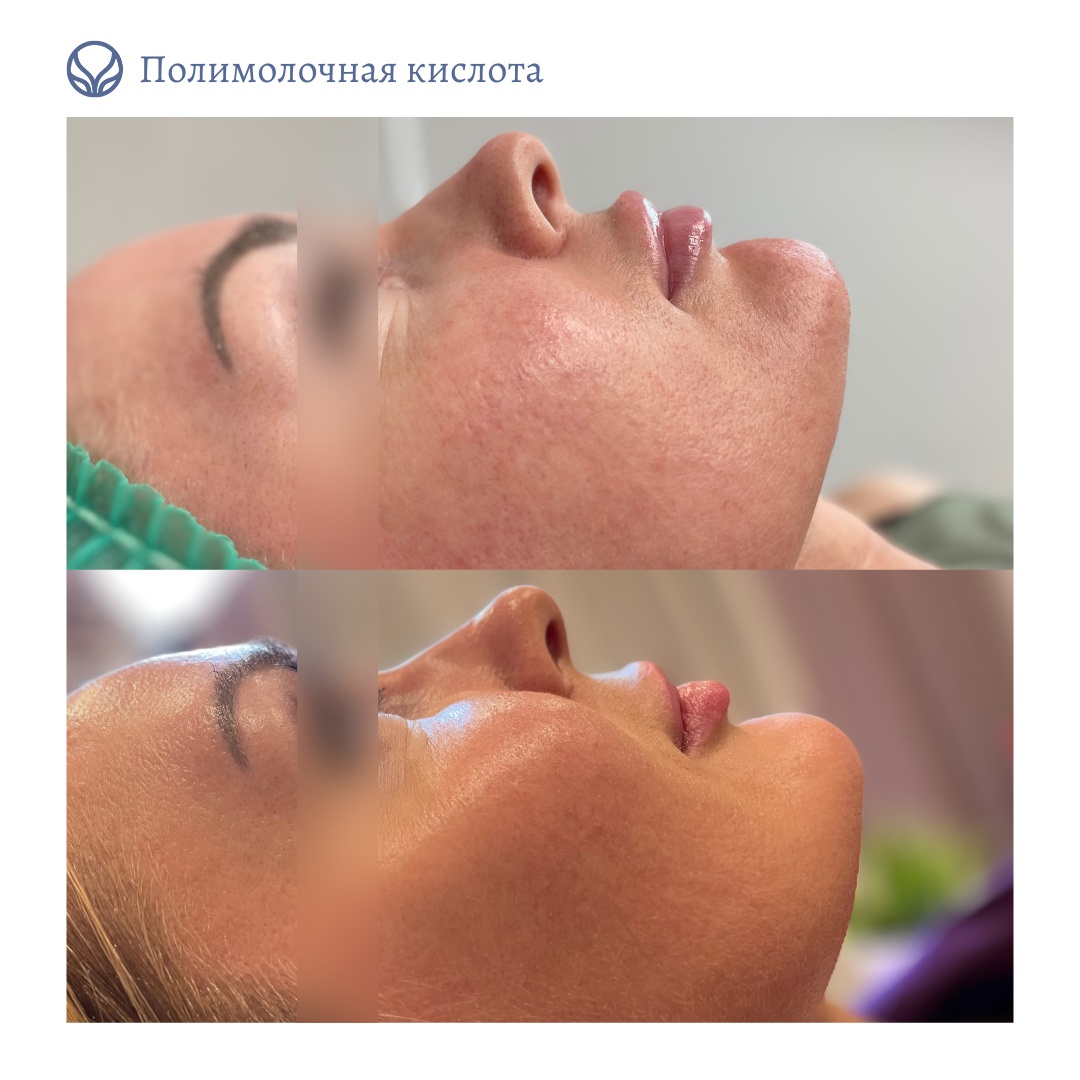 69054861__https://filllin.ru/api/media/doctor/8b0651f2-e398-4771-b7a9-fc782c17b700-6641d6971b708b73903b2c1d.jpeg