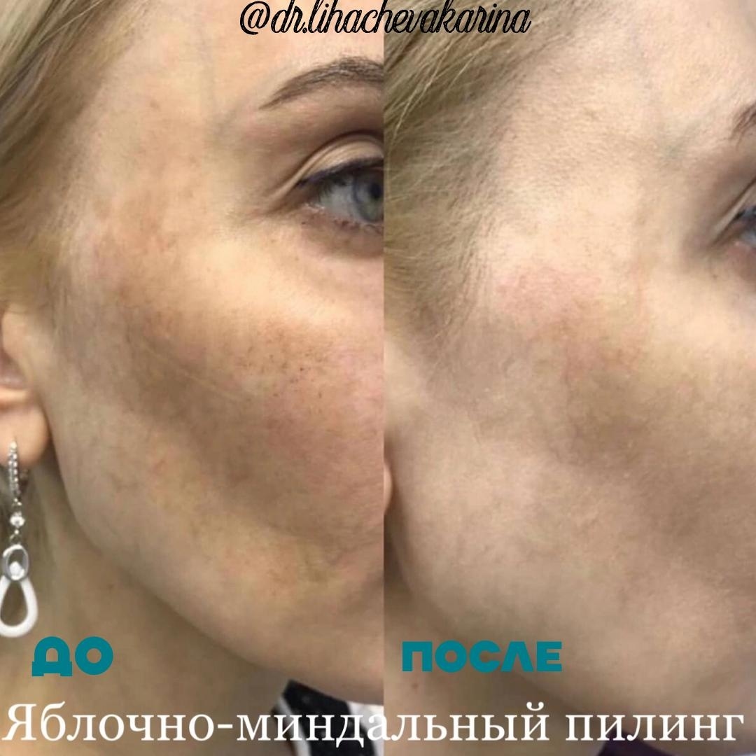 352217649__https://filllin.ru/api/media/doctor/8b208a85-498e-426f-b8e0-d459550cd366-6641d6971b708b73903b2c1d.jpg