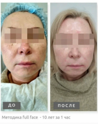 209665964__https://filllin.ru/api/media/doctor/8ffd8c29-1307-4b84-a3c8-4533706b179a-6641d6971b708b73903b2c1d.png