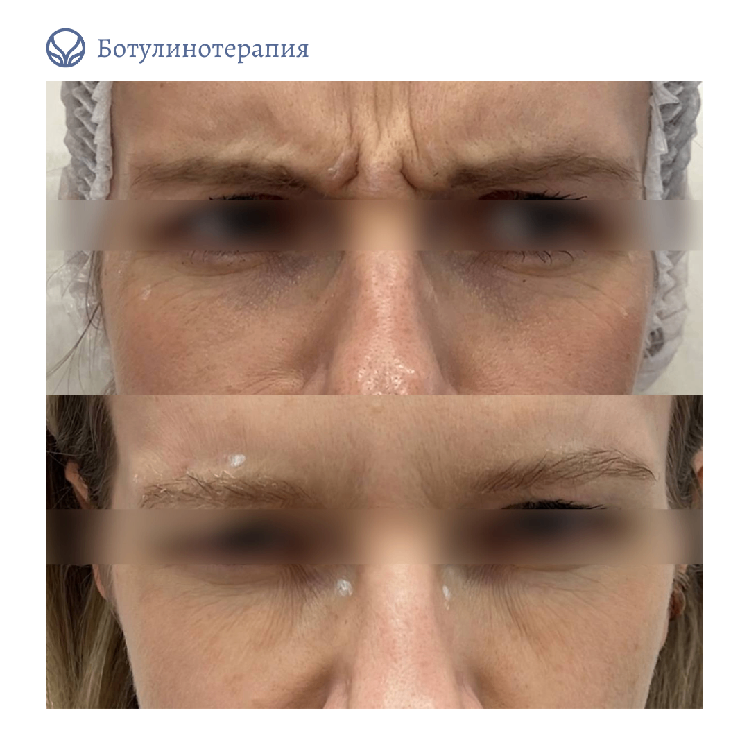 62014032__https://filllin.ru/api/media/doctor/90047bd0-e3be-4e1a-9ead-01886fccf0f9-6641d6971b708b73903b2c1d.png