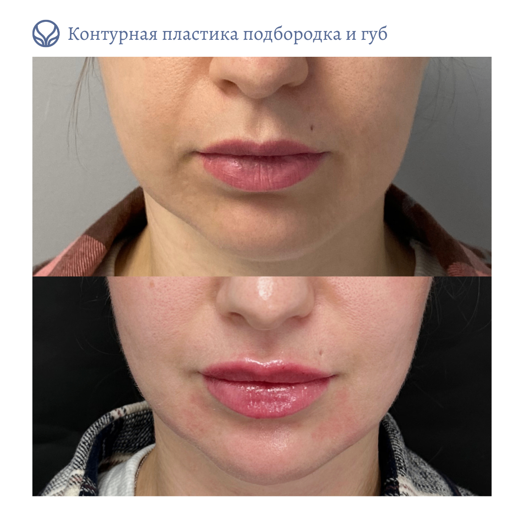 64844681__https://filllin.ru/api/media/doctor/967f8fbc-70e5-4147-bb09-a4c871c626f8-6641d6971b708b73903b2c1d.png