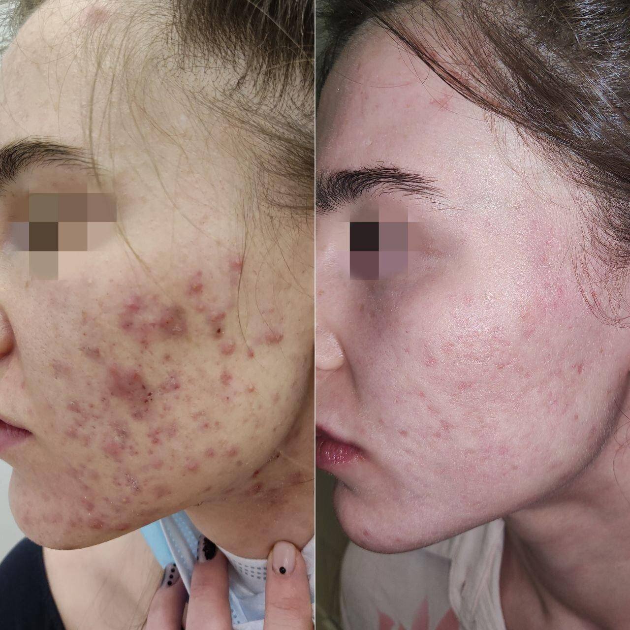 435981917__https://filllin.ru/api/media/doctor/9889c2e8-d5a7-4613-a9db-f53f68211f05-67618e0e145943c8628e7ed5.jpg