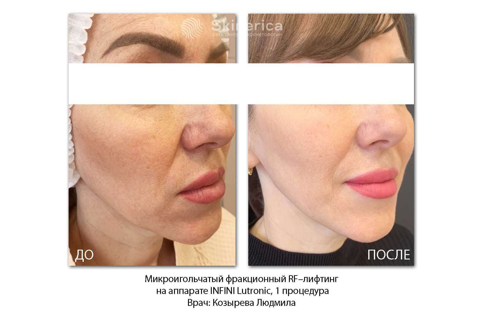 212022042__https://filllin.ru/api/media/doctor/9a56c315-8607-440c-9be1-fbdc36692092-6641d6971b708b73903b2c1d.jpg