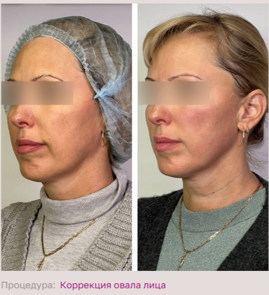 602492197__https://filllin.ru/api/media/doctor/9a8166d8-bbe8-462e-8895-335271973c7d-68d2b334d611ae3c0dcef079.png