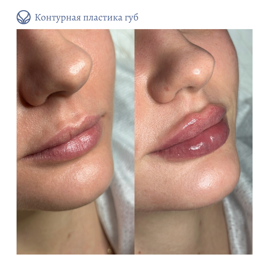63423279__https://filllin.ru/api/media/doctor/9b0ccc0e-651c-4074-aaf6-79aa1bf1350f-6641d6971b708b73903b2c1d.png