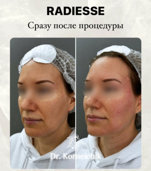 352224966__https://filllin.ru/api/media/doctor/9c30d6bb-7fea-4d7f-8944-b6f8aa58c0b1-6641d6971b708b73903b2c1d.png