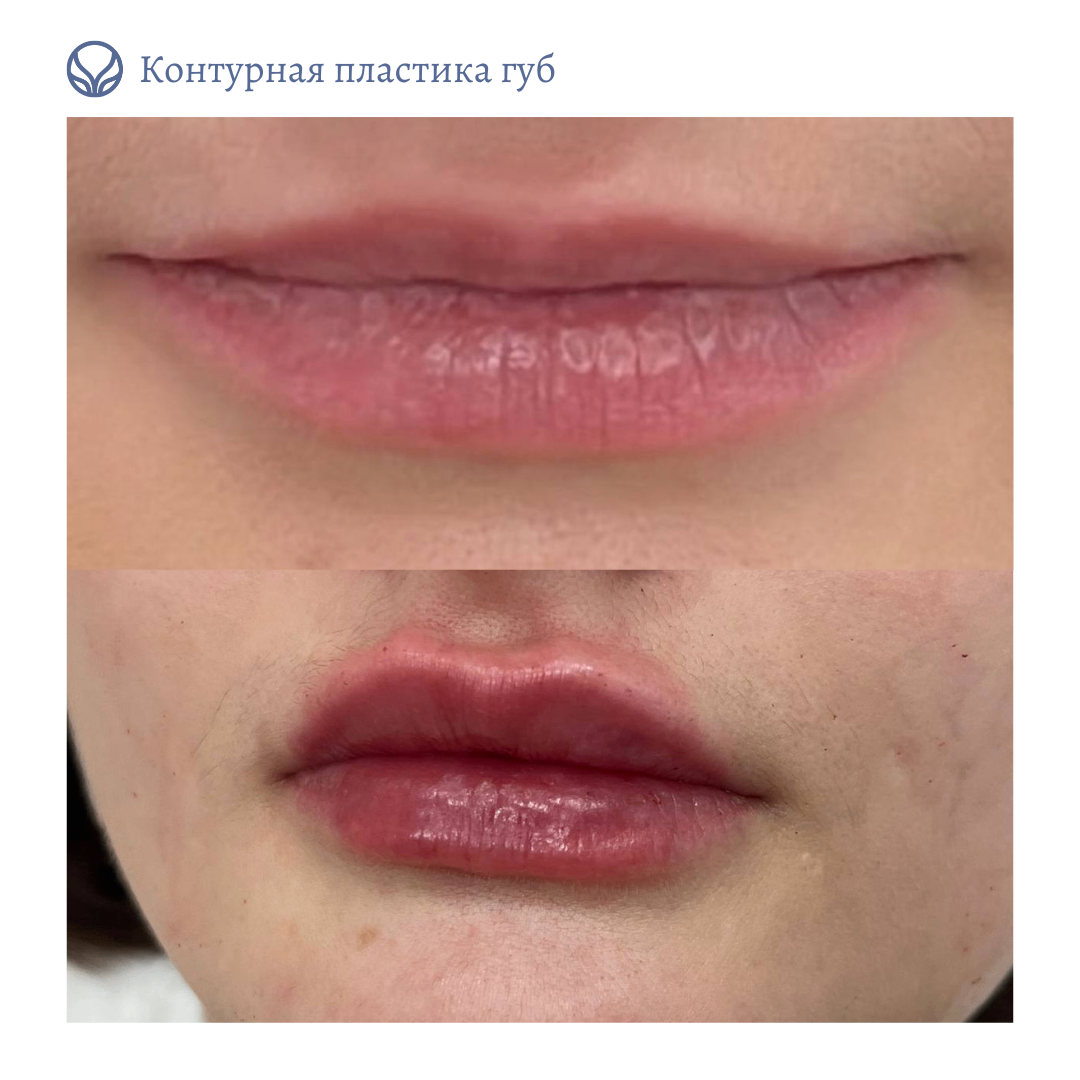 69138892__https://filllin.ru/api/media/doctor/9c8ab2a3-bf00-45a7-be5e-a85f5452c987-6641d6971b708b73903b2c1d.png
