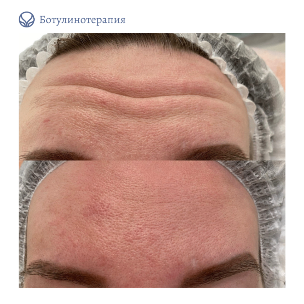 68347819__https://filllin.ru/api/media/doctor/9cd58588-74fc-429c-9ac7-840d7da7069f-6641d6971b708b73903b2c1d.png