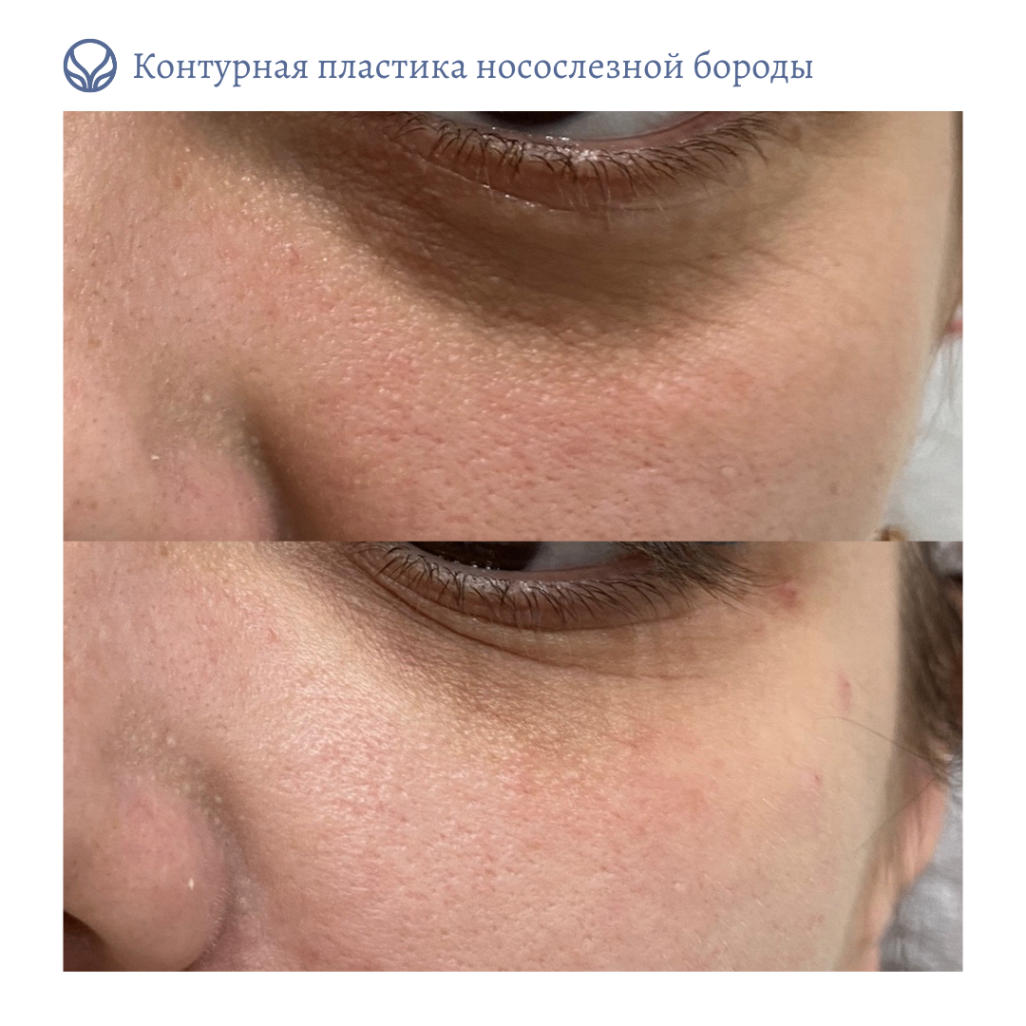 68347819__https://filllin.ru/api/media/doctor/9f08a634-3b0e-4c64-9212-9a06bfd48ebf-6641d6971b708b73903b2c1d.png