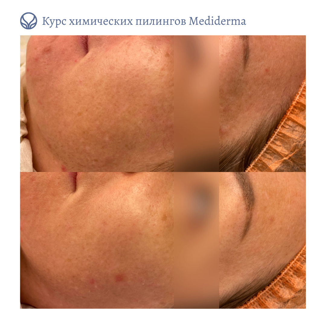 63550010__https://filllin.ru/api/media/doctor/9fd2ee6c-51ae-45db-9f43-5c636a29b572-6641d6971b708b73903b2c1d.png