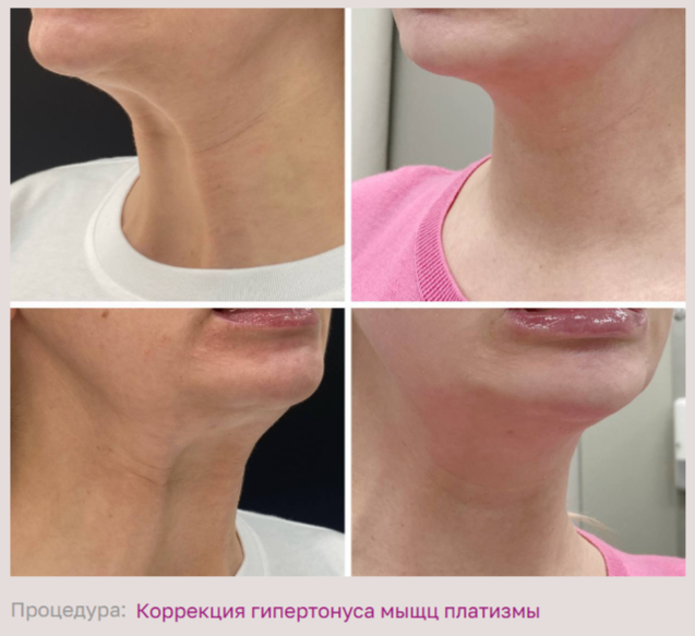 602492197__https://filllin.ru/api/media/doctor/a2d33ea9-5a8d-4607-8c15-96968f02440b-68d2b334d611ae3c0dcef079.png