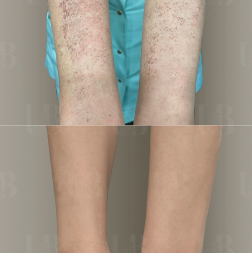 130636249__https://filllin.ru/api/media/doctor/a2e0b3f4-bc08-414a-b5a4-7706f5a0a61e-6641d6971b708b73903b2c1d.png