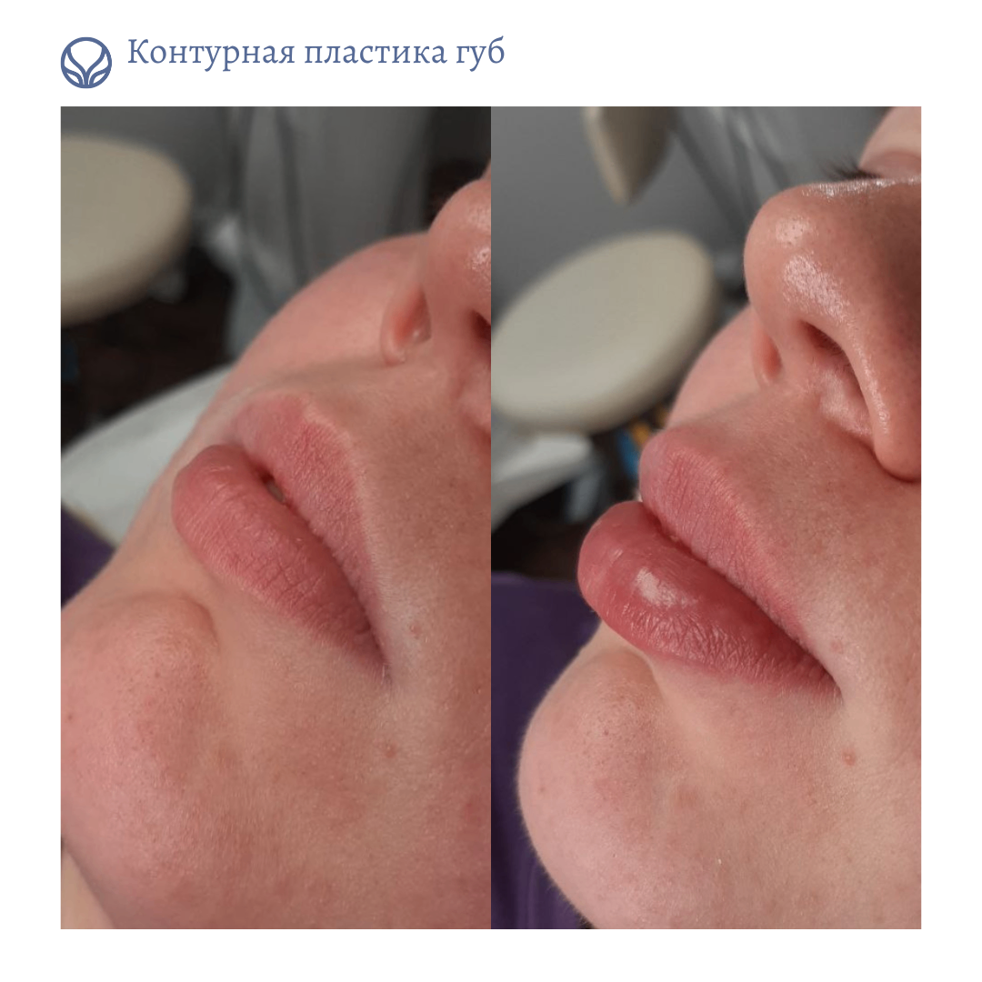 67216317__https://filllin.ru/api/media/doctor/a319ff9d-193b-45b7-9d9a-a242e28ad44a-6641d6971b708b73903b2c1d.png