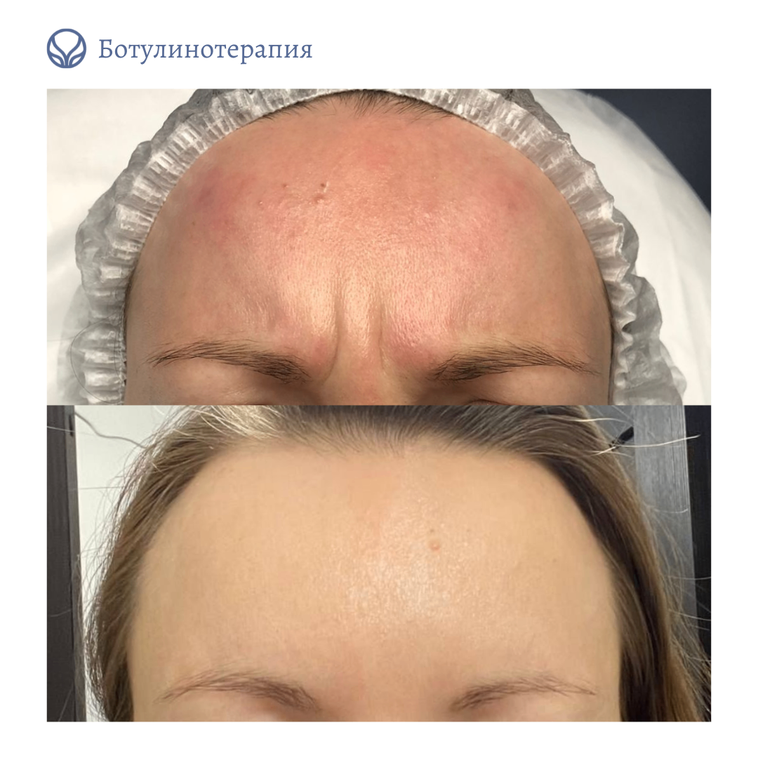 62014032__https://filllin.ru/api/media/doctor/a463dace-5e09-4eb4-8040-65012fe0db9e-6641d6971b708b73903b2c1d.png