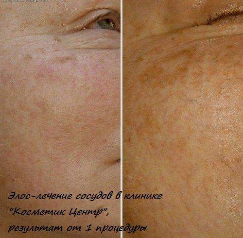 130636249__https://filllin.ru/api/media/doctor/a5af9a92-890e-4df1-b46a-737e8f7478e2-6641d6971b708b73903b2c1d.jpg