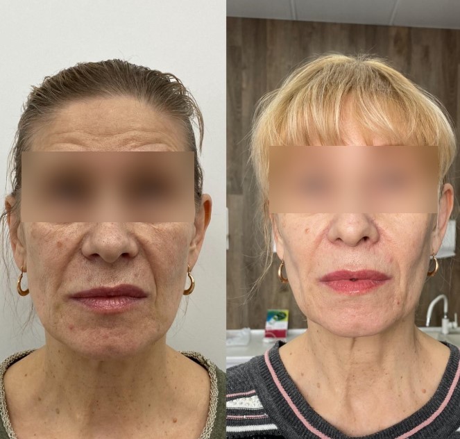 440191775__https://filllin.ru/api/media/doctor/a6927fea-6cba-40cc-9ffb-6835a1e57f35-6641d6971b708b73903b2c1d.jpg