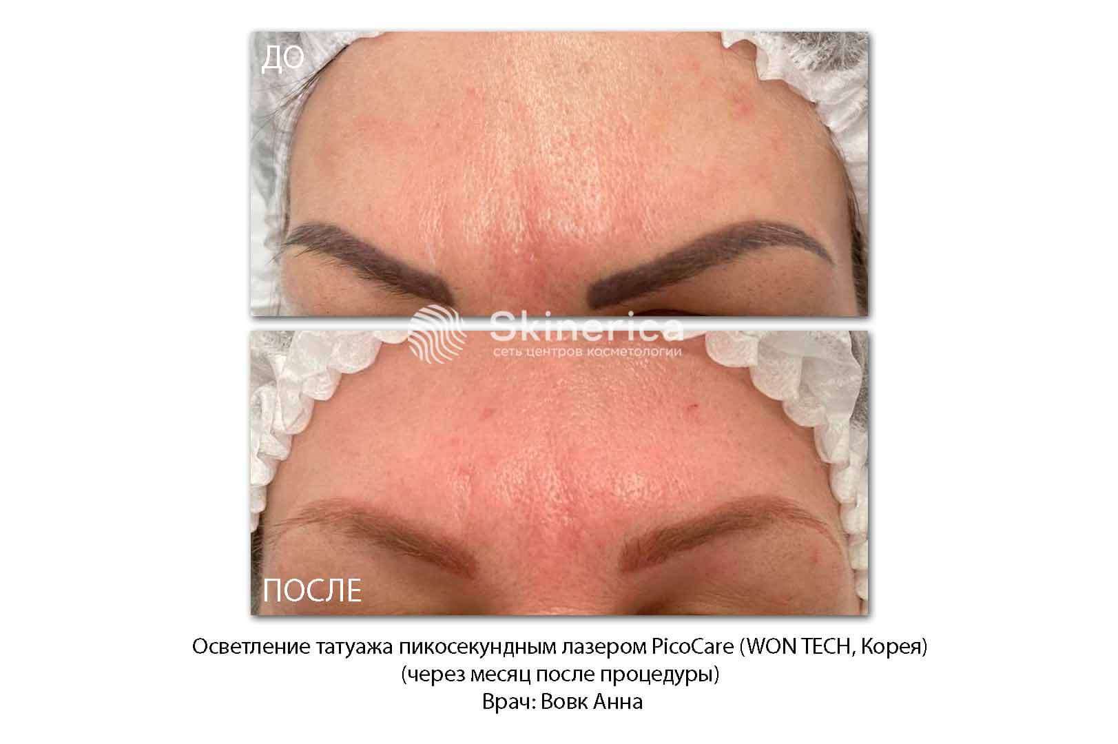 211570337__https://filllin.ru/api/media/doctor/a71566b9-b513-44cf-9adc-00a8a914a88d-6641d6971b708b73903b2c1d.jpg
