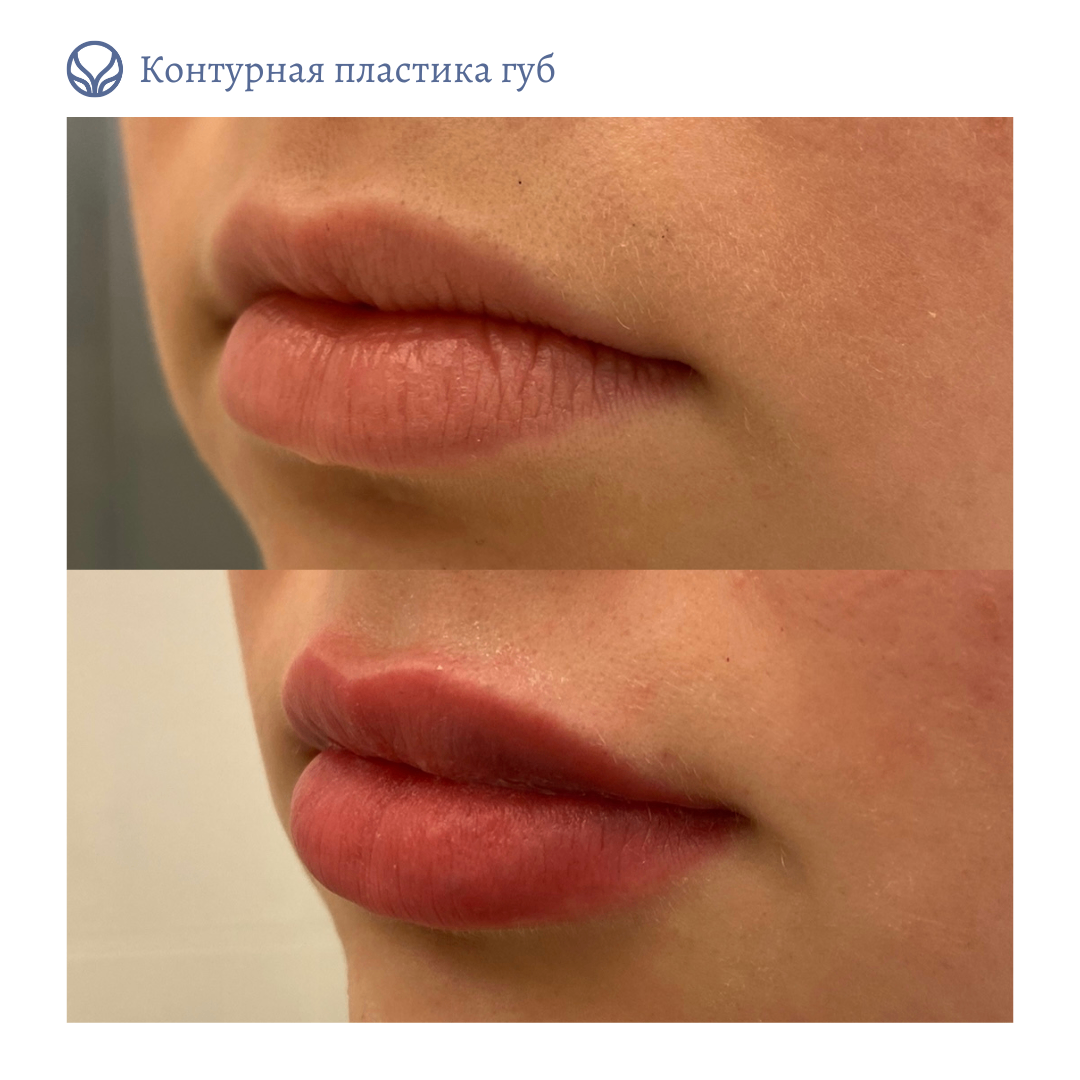 63550010__https://filllin.ru/api/media/doctor/a7640403-c21b-4d24-9461-d10400cc4fb5-6641d6971b708b73903b2c1d.png