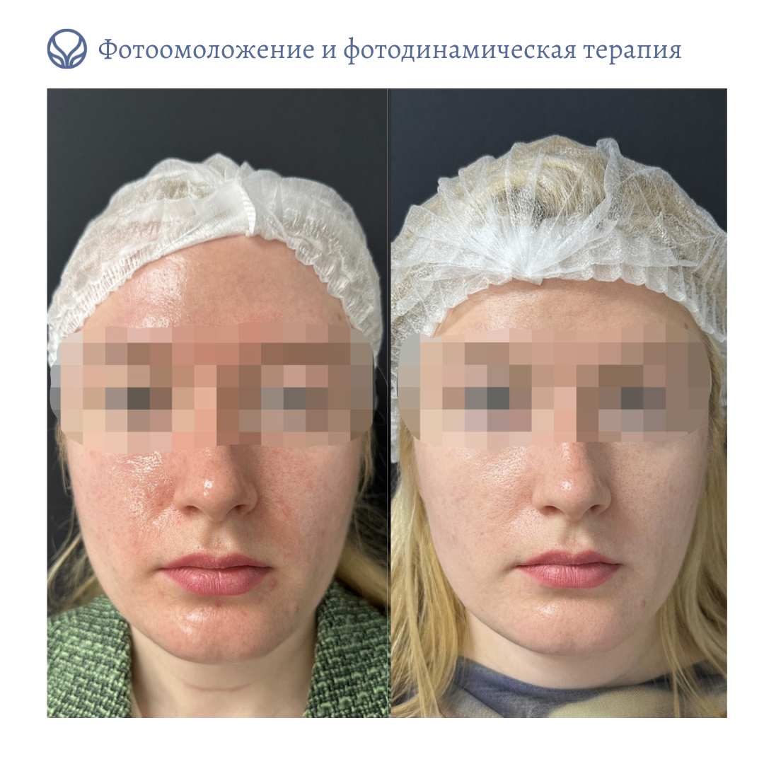 74143140__https://filllin.ru/api/media/doctor/a7bea415-72db-4271-9c62-57c804e55bf3-6641d6971b708b73903b2c1d.png