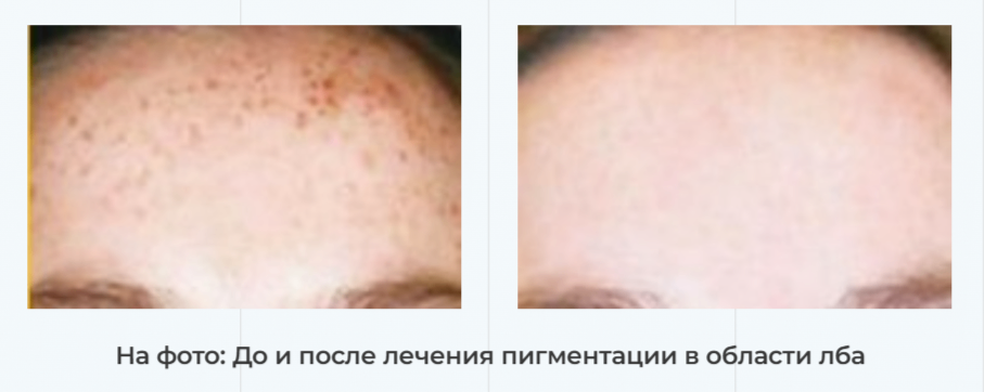 209082136__https://filllin.ru/api/media/doctor/ac6e4c44-57a2-441e-9633-3fd86363326e-6641d6971b708b73903b2c1d.png