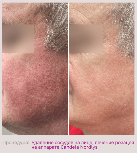 587358550__https://filllin.ru/api/media/doctor/aeb58493-5519-4dbb-8cbe-ec14cb61457b-68d2b334d611ae3c0dcef079.png