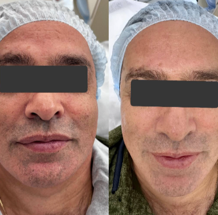 353029158__https://filllin.ru/api/media/doctor/aeb7f62a-068f-42f0-ab5f-8220ba109494-6641d6971b708b73903b2c1d.png