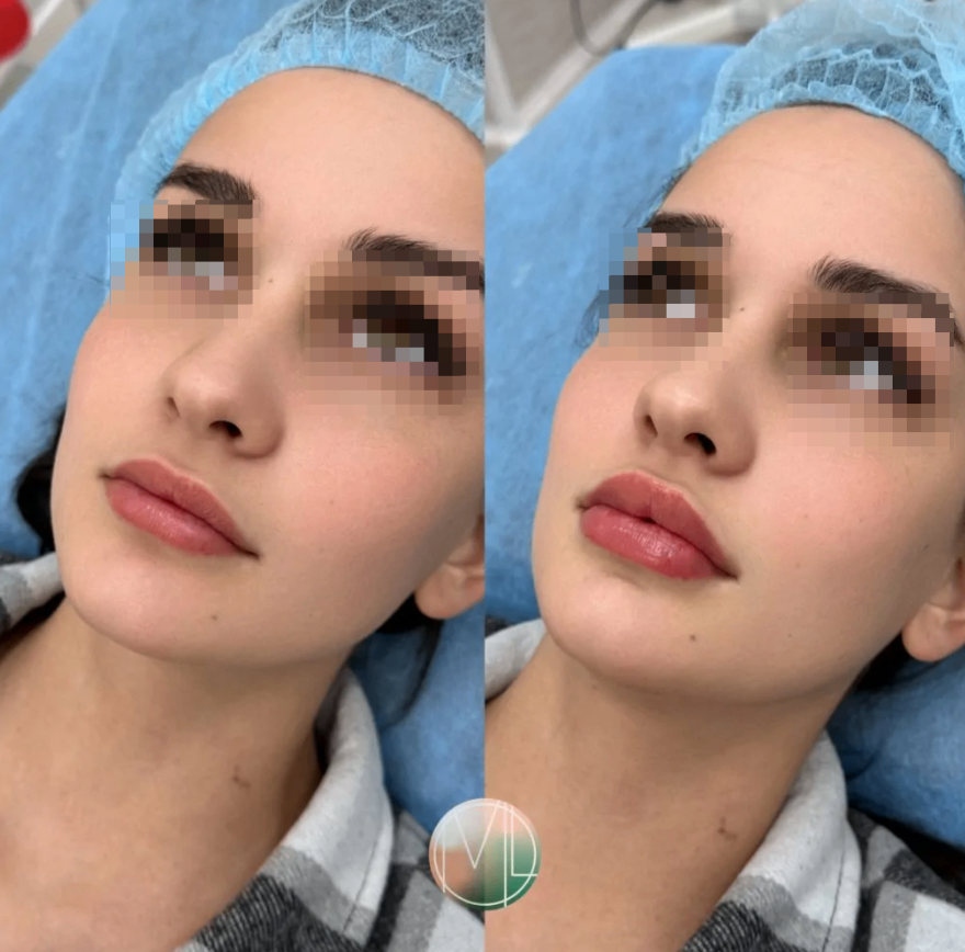 529115635__https://filllin.ru/api/media/doctor/aecaff40-18dd-4c6a-b1e0-fa2e3767827c-68d2b334d611ae3c0dcef079.png