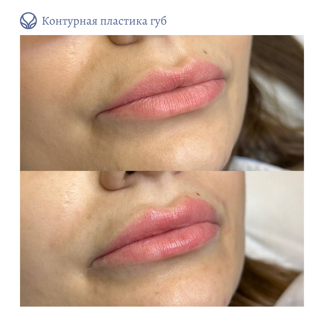 63532625__https://filllin.ru/api/media/doctor/af4ced17-ebfd-4c60-9f56-555aeb0895f7-6641d6971b708b73903b2c1d.png
