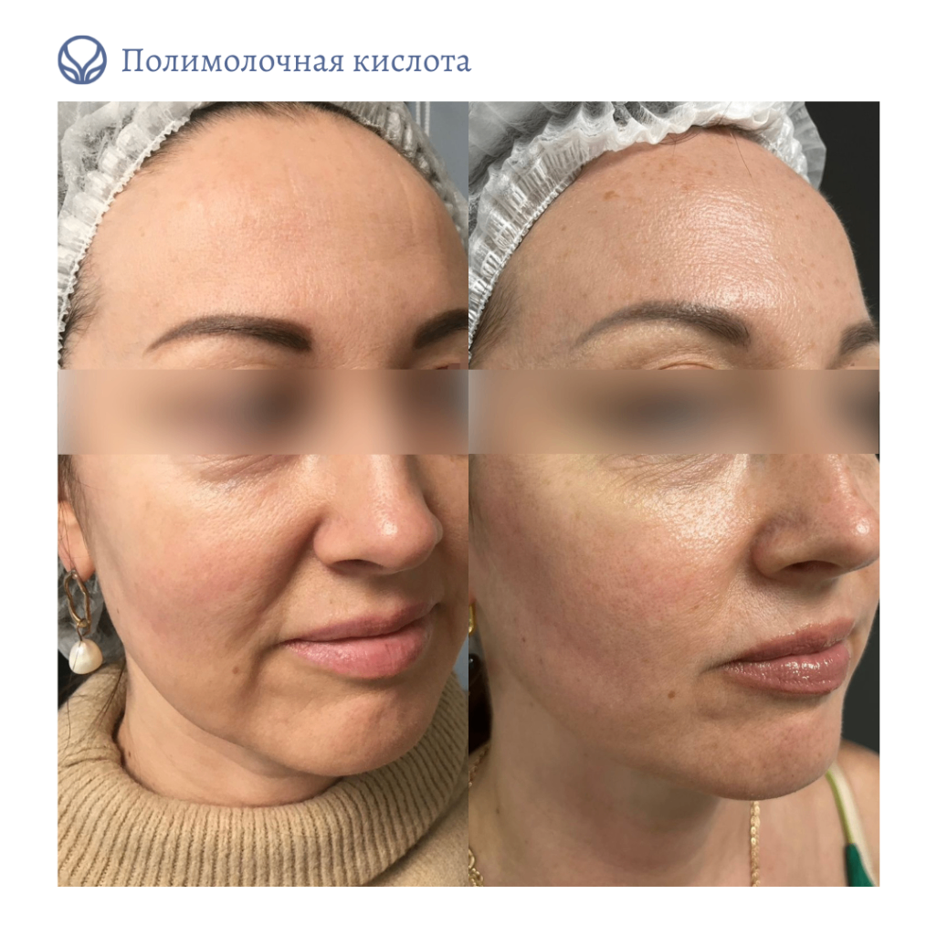 69054861__https://filllin.ru/api/media/doctor/af79353a-26b5-4e07-a7f6-7f6b4d1ee071-6641d6971b708b73903b2c1d.png