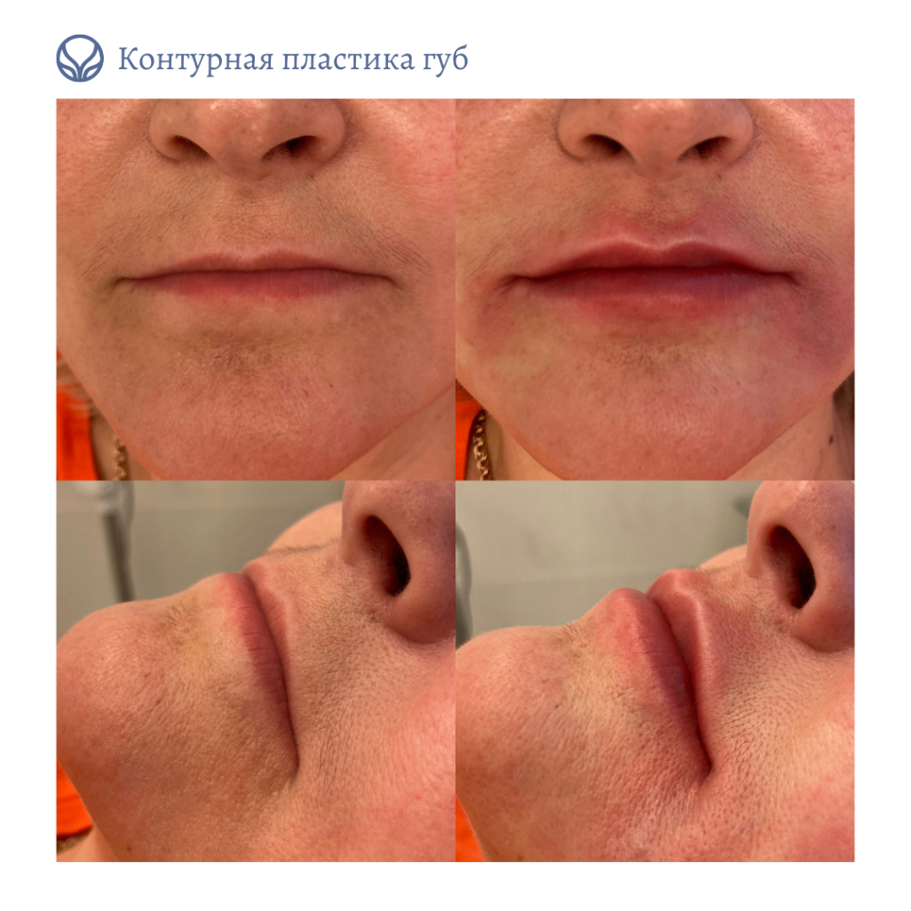 63550010__https://filllin.ru/api/media/doctor/b13b3d45-b05c-40a9-810d-c90e831b84de-6641d6971b708b73903b2c1d.png