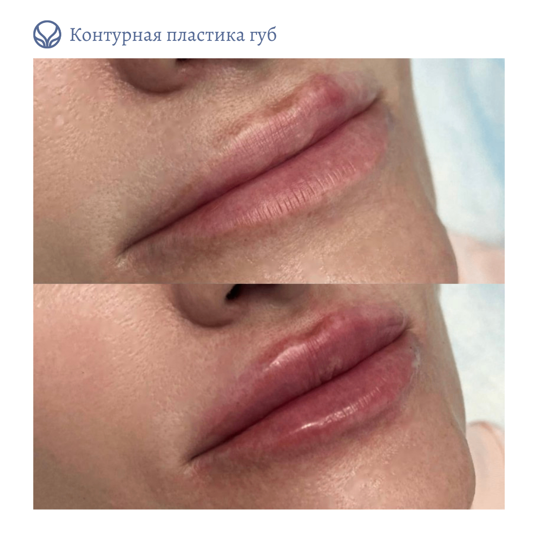 69043717__https://filllin.ru/api/media/doctor/b3628981-93ea-427c-b83b-a0cca8f63920-6641d6971b708b73903b2c1d.png