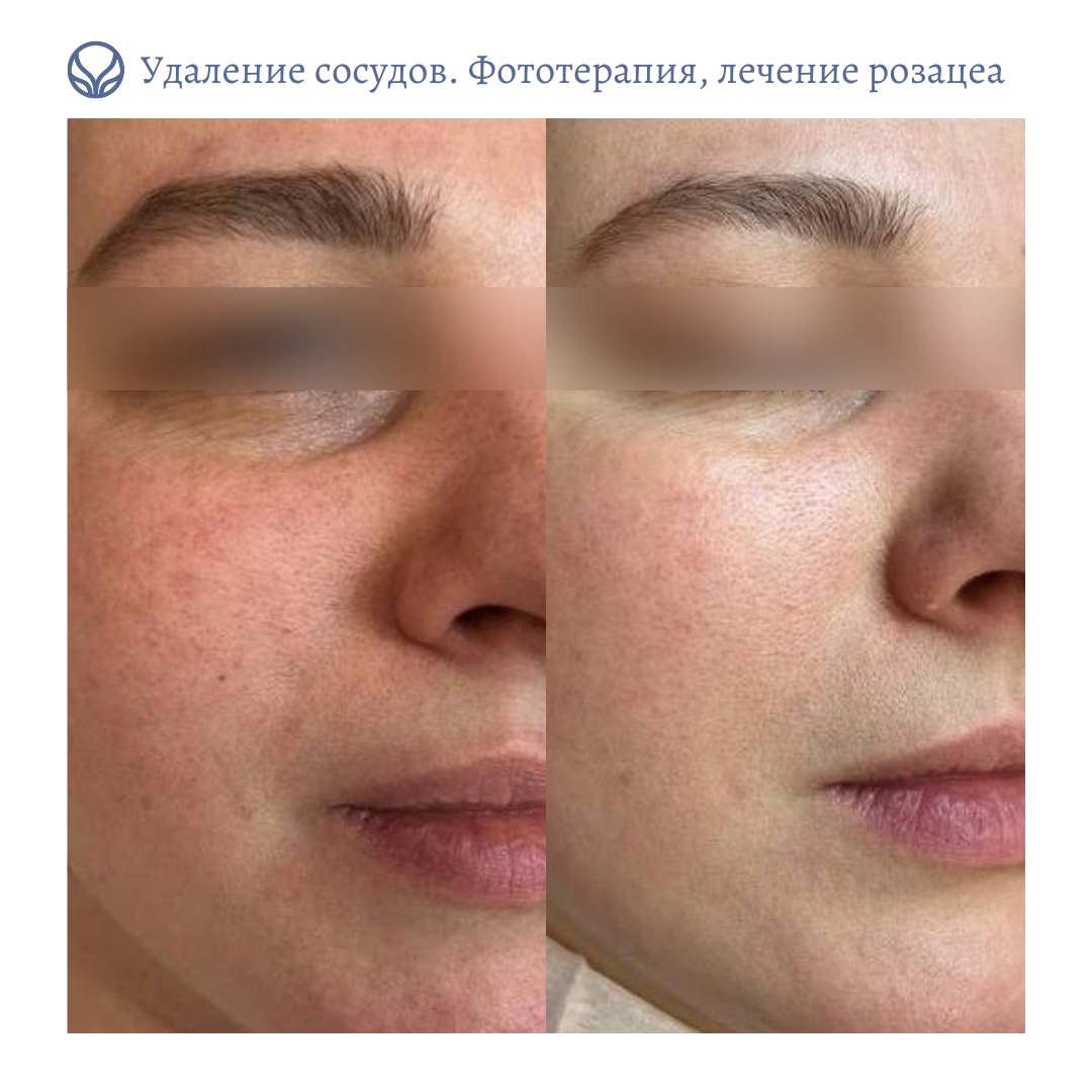 69054861__https://filllin.ru/api/media/doctor/b3c8059f-172a-4ea3-86ee-eae0ef62d0c1-6641d6971b708b73903b2c1d.png