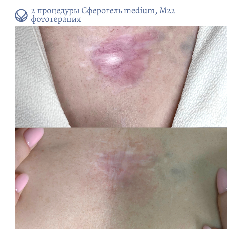64844681__https://filllin.ru/api/media/doctor/b446ccdb-3718-42ce-b303-4e71828108c7-6641d6971b708b73903b2c1d.png