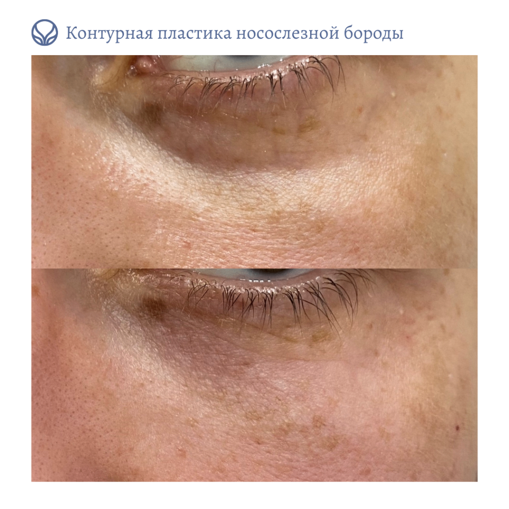 68347819__https://filllin.ru/api/media/doctor/b50b7040-5158-4885-a101-52ca2e4e6a13-6641d6971b708b73903b2c1d.png