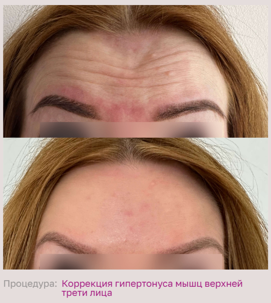602492197__https://filllin.ru/api/media/doctor/b698658b-6715-42ae-9fe4-ba9304121dd3-68d2b334d611ae3c0dcef079.png