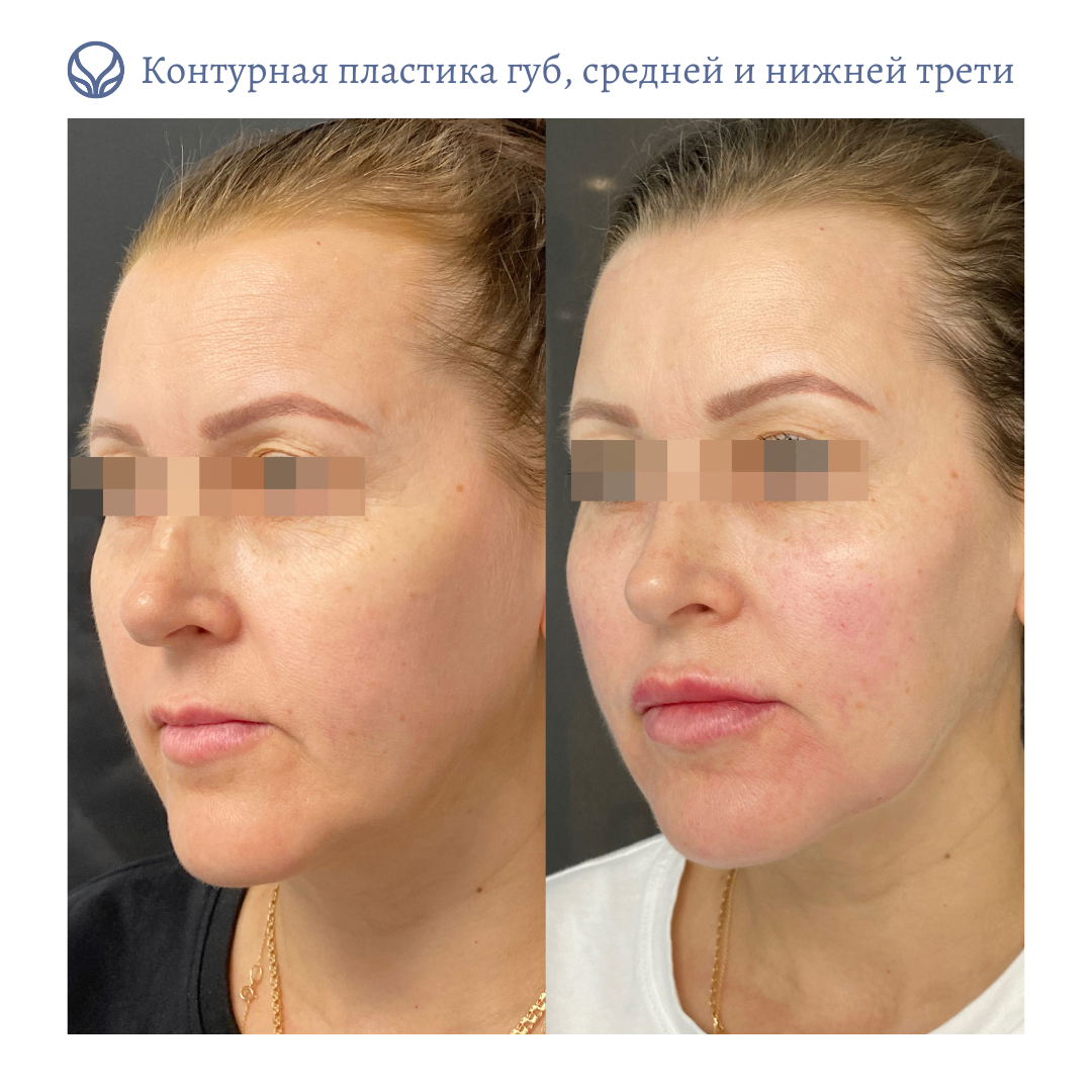 64844681__https://filllin.ru/api/media/doctor/b9816a31-a860-4759-955f-77076dfd2516-6641d6971b708b73903b2c1d.png