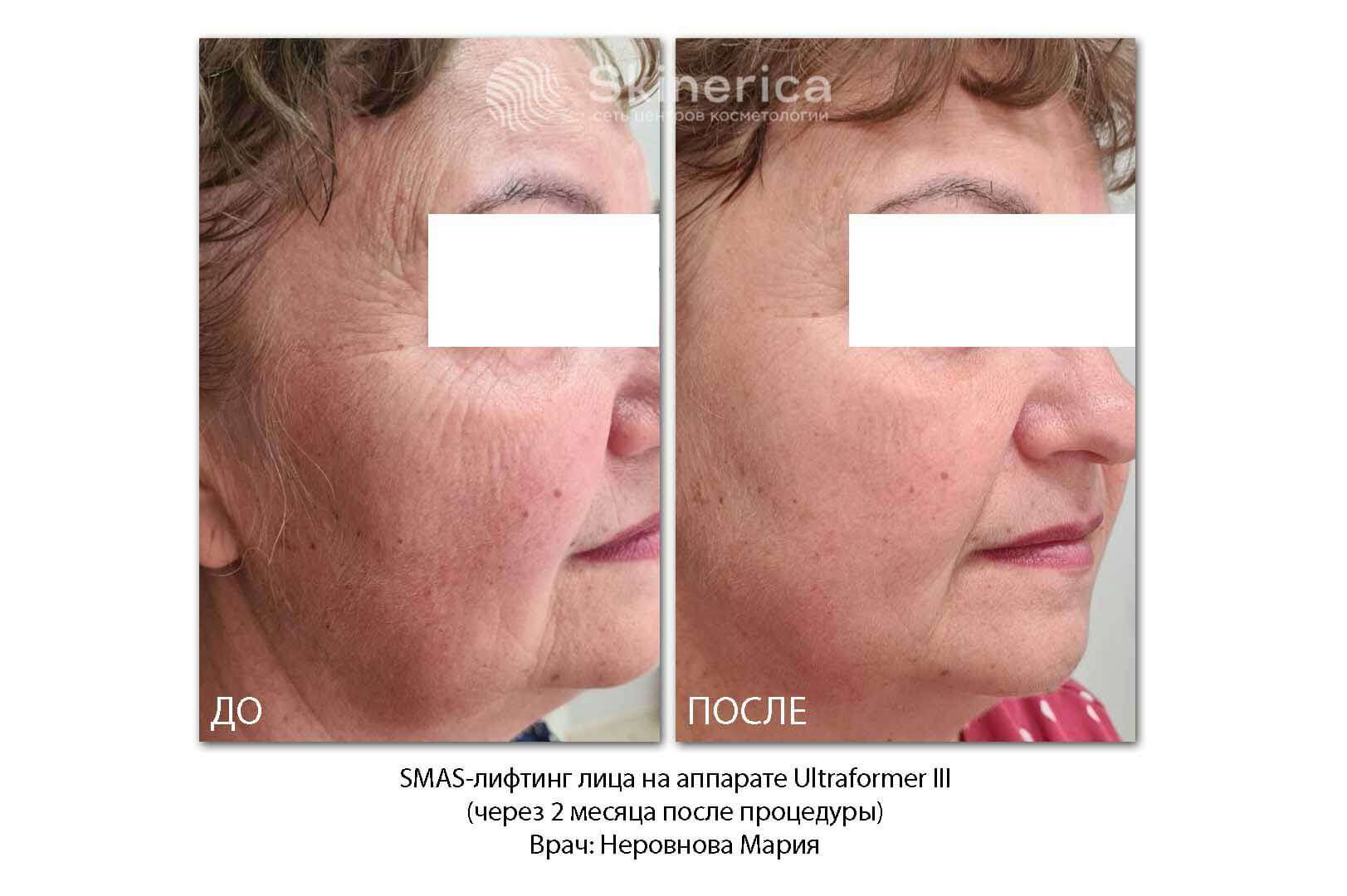 212022042__https://filllin.ru/api/media/doctor/ba8e58db-d397-4fde-aba3-c6a8e2c71497-6641d6971b708b73903b2c1d.jpg