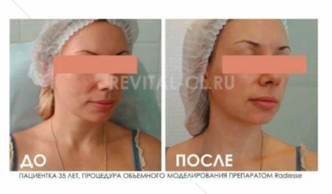 209665964__https://filllin.ru/api/media/doctor/baf4eda8-2606-4ab4-bce1-435edbca820e-6641d6971b708b73903b2c1d.png
