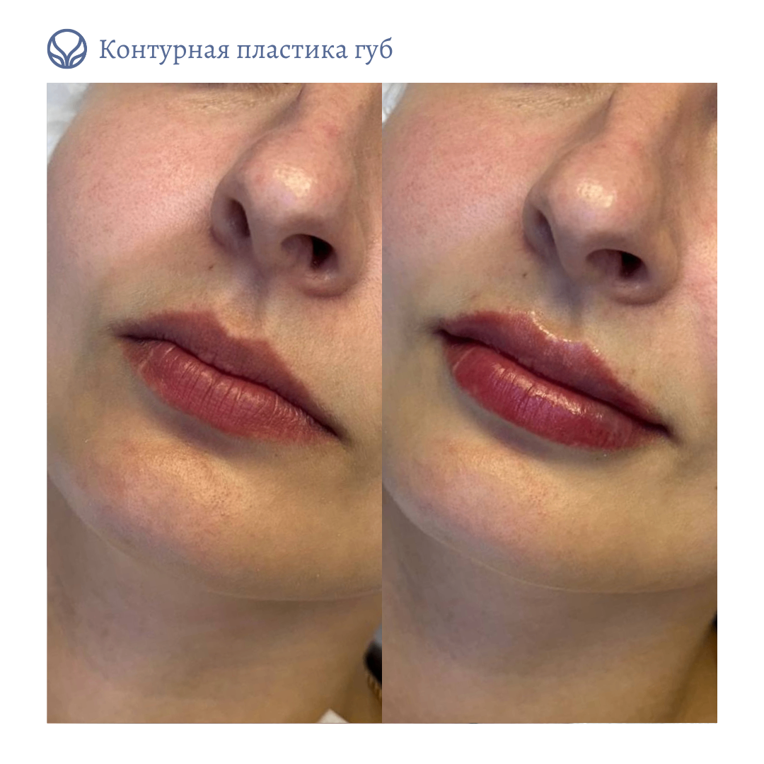 63553855__https://filllin.ru/api/media/doctor/be32f709-917e-420c-bf09-c07fb21fcc1e-6641d6971b708b73903b2c1d.png