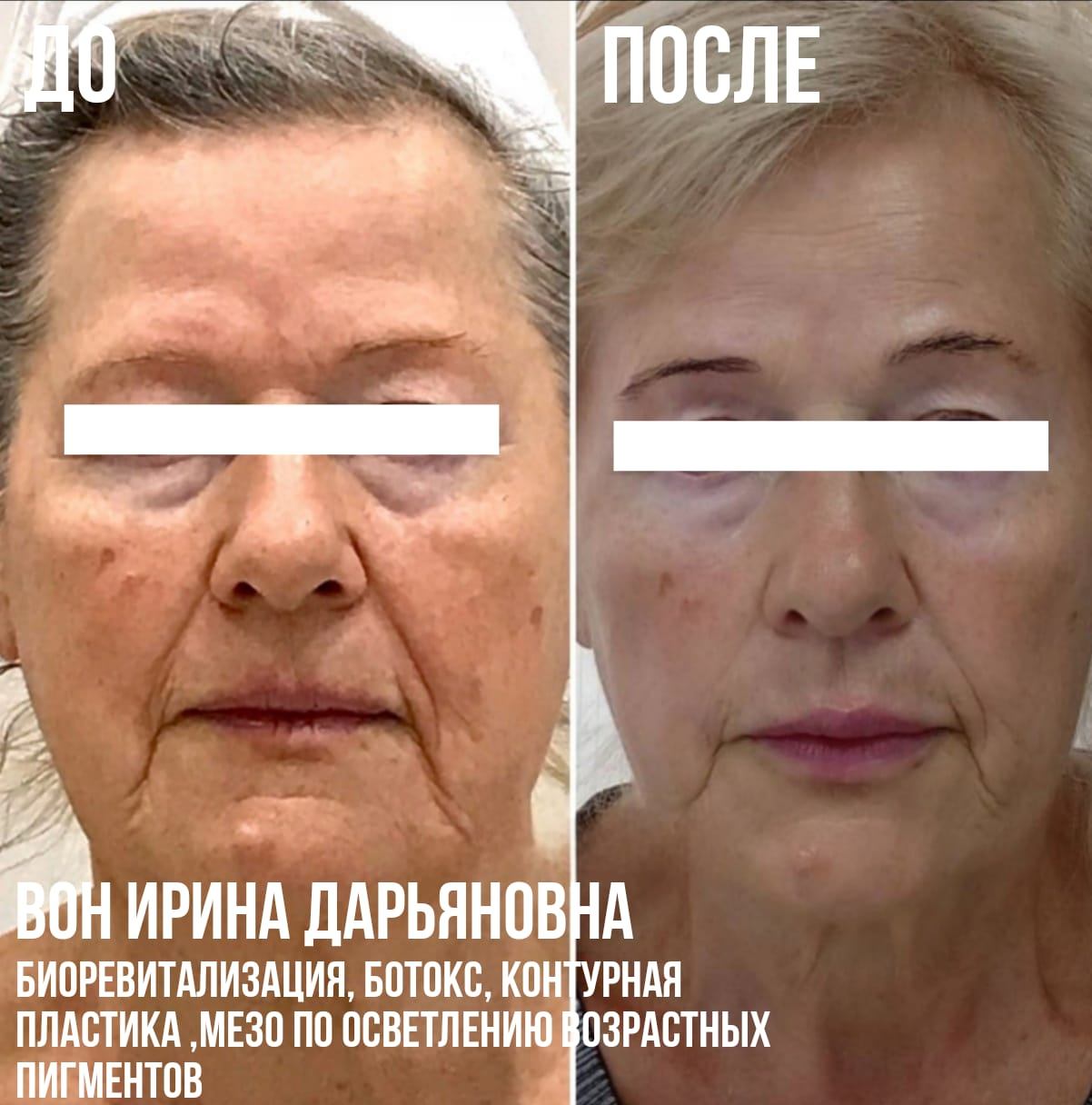 457198385__https://filllin.ru/api/media/doctor/bec7b088-14ed-4889-9215-6ba94160b2c5-6641d6971b708b73903b2c1d.jpg