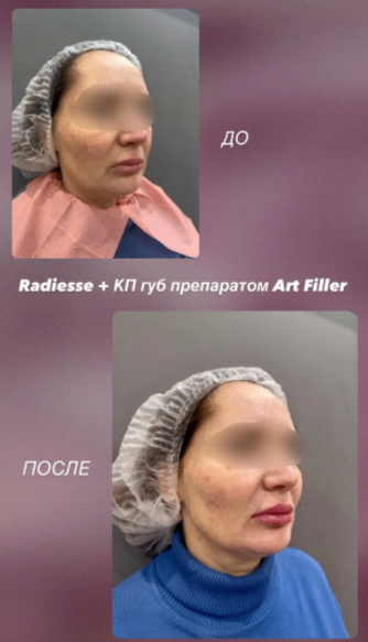 352224966__https://filllin.ru/api/media/doctor/c2dfeece-1699-4c79-b342-5d8820774983-6641d6971b708b73903b2c1d.png