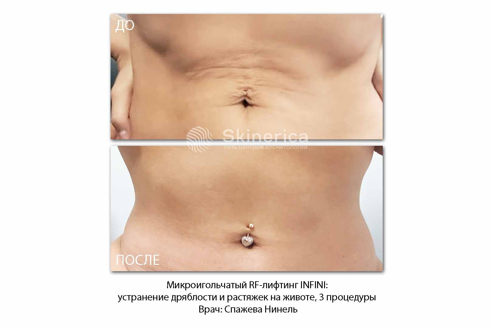 212022042__https://filllin.ru/api/media/doctor/c359e18e-dd1a-47c1-9326-8b852719653c-6641d6971b708b73903b2c1d.jpg