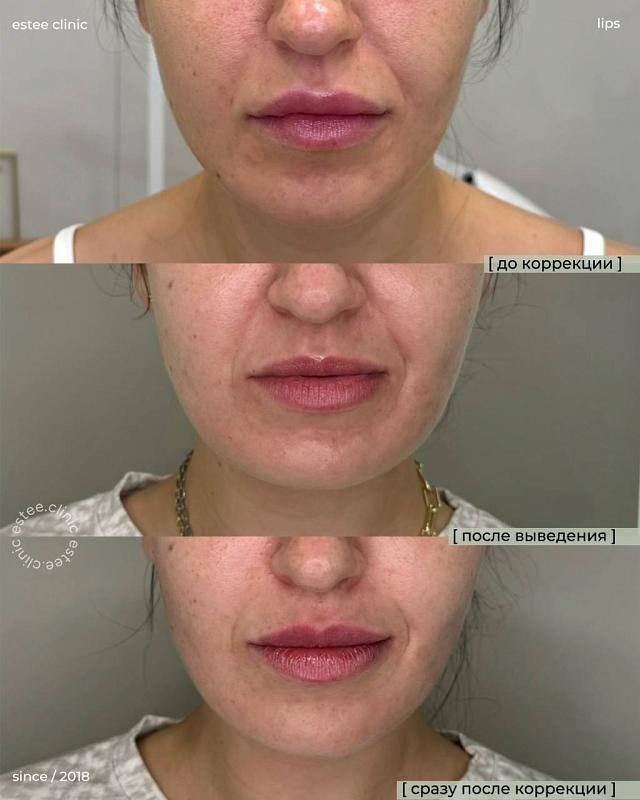 135377169__https://filllin.ru/api/media/doctor/c7c764ed-aba7-44b4-95a3-5e2318b3fa98-6641d6971b708b73903b2c1d.jpeg