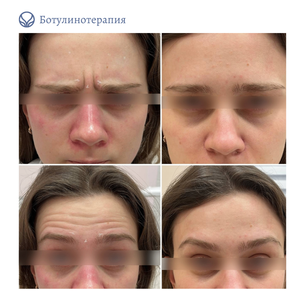 62014032__https://filllin.ru/api/media/doctor/ca9a4297-aaab-4fbc-ad6f-4a0c66db1314-6641d6971b708b73903b2c1d.png