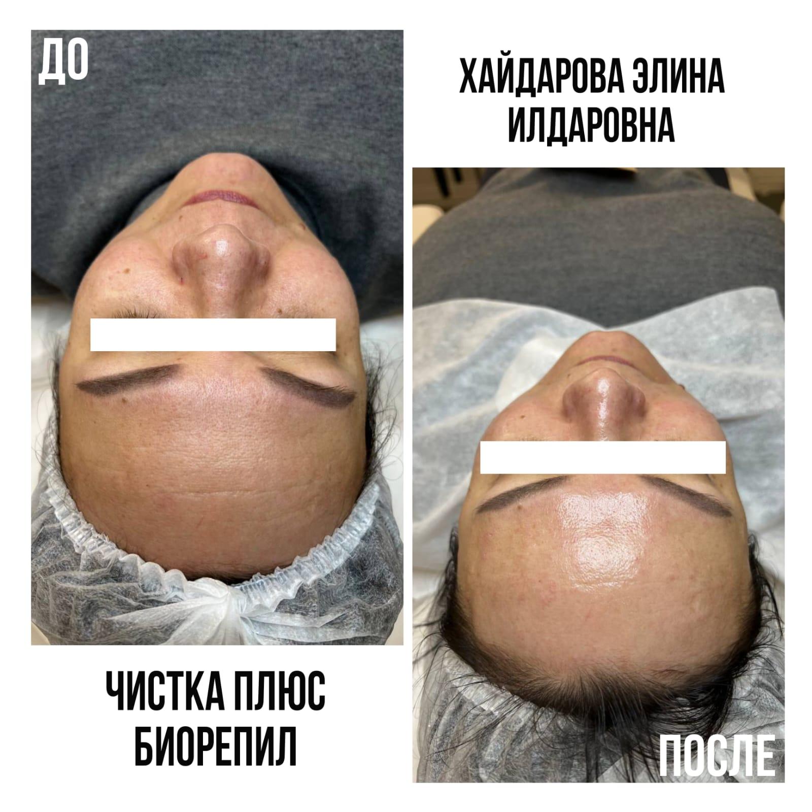 461267447__https://filllin.ru/api/media/doctor/cab2892c-9d9f-495e-b8bc-7c0ea22e2d20-6641d6971b708b73903b2c1d.jpg