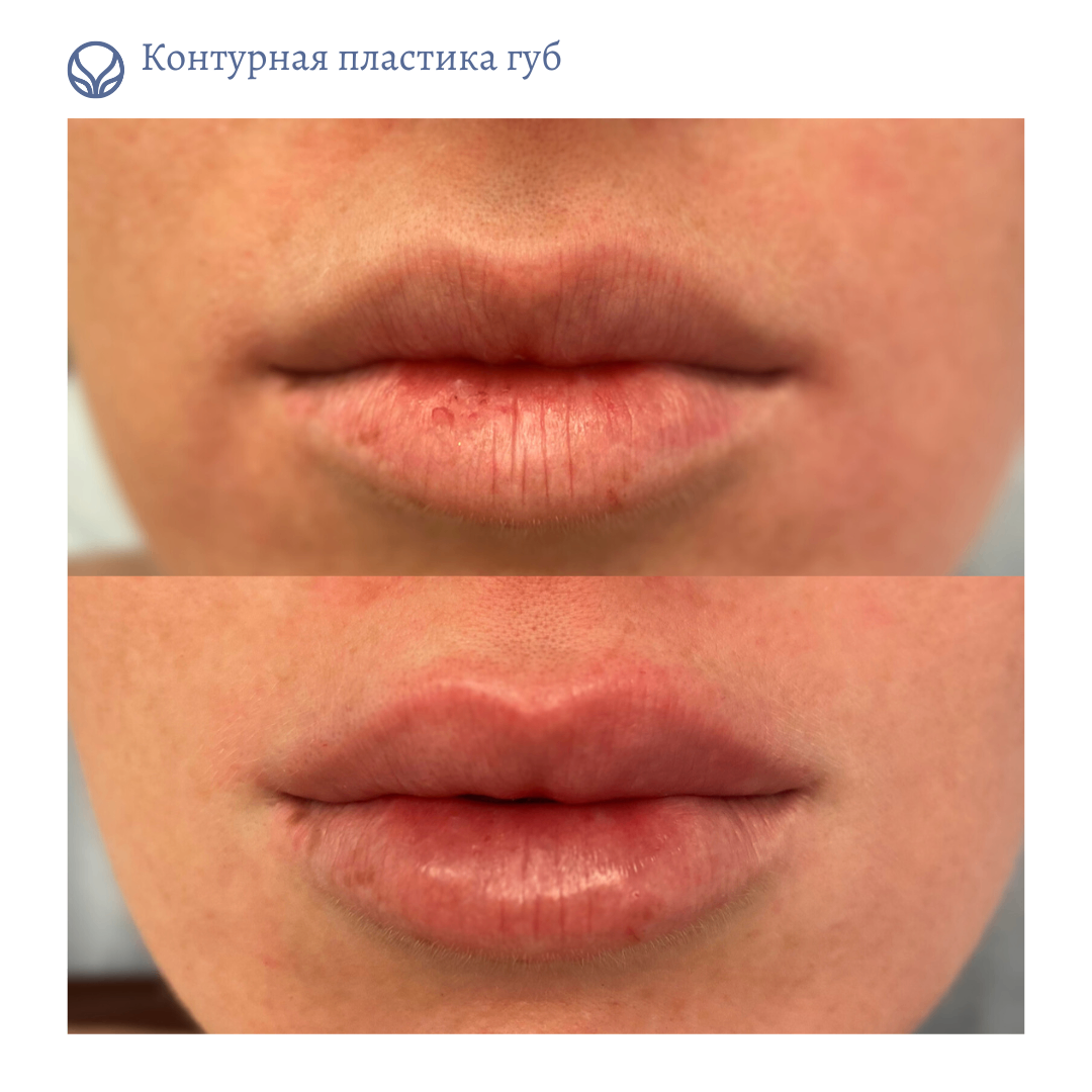 63550010__https://filllin.ru/api/media/doctor/cb74c14b-ac4b-4e92-a9b2-ab68be20f00d-6641d6971b708b73903b2c1d.png