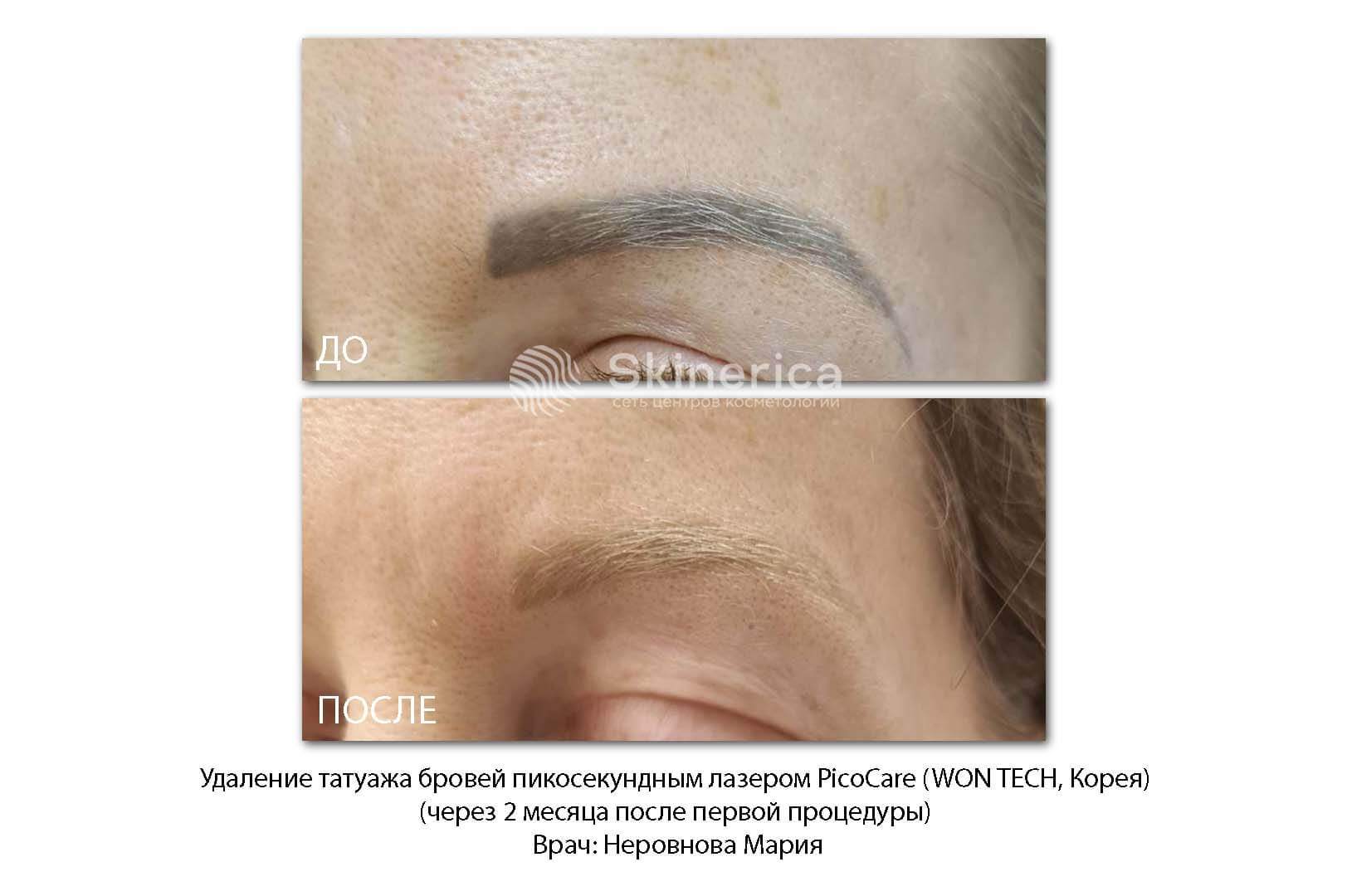 211570337__https://filllin.ru/api/media/doctor/ce6805f6-89a3-4f9b-ac58-b4602a53027e-6641d6971b708b73903b2c1d.jpg