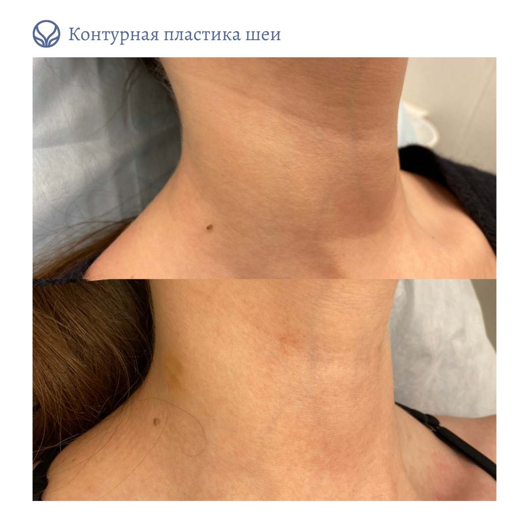 63550010__https://filllin.ru/api/media/doctor/cea6fc5c-6404-497c-9367-1a3f85df6f8c-6641d6971b708b73903b2c1d.png