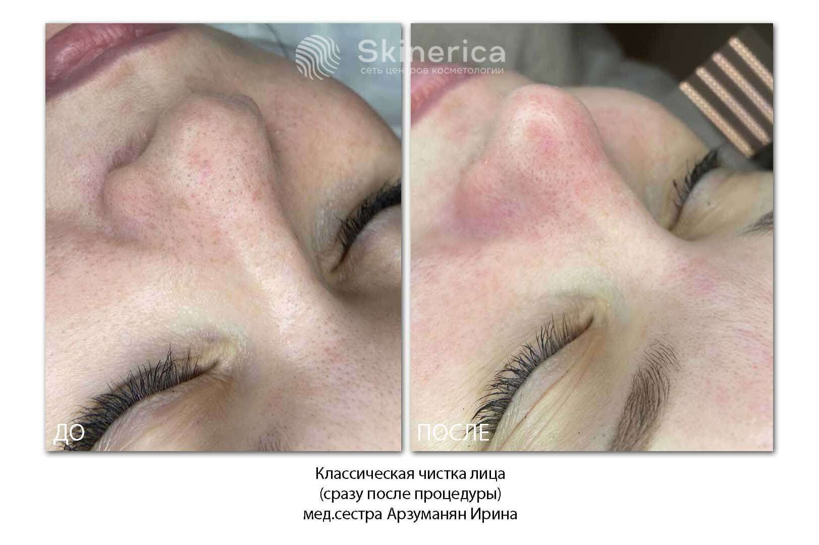 211982165__https://filllin.ru/api/media/doctor/cf0b1f93-0d78-4b5b-a714-f89f5b6d6eb6-6641d6971b708b73903b2c1d.jpg